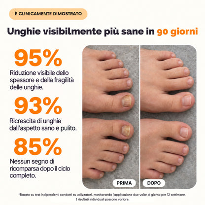 Olvéa Spray contro la micosi delle unghie