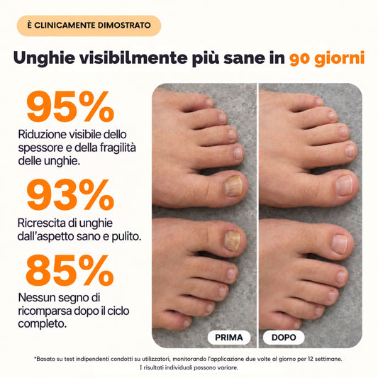 Olvéa Spray contro la micosi delle unghie