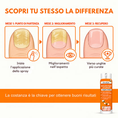 Olvéa Spray contro la micosi delle unghie